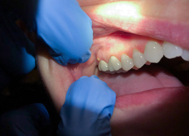 Best Urgent Dental Care for Toothache in Roxana, IL